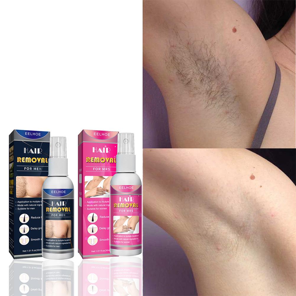 1/2PCS Super Natural Painless  - Hair Care Lotion ulasan dan harga